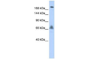 VPS8 antibody used at 1 ug/ml to detect target protein. (VPS8 antibody)