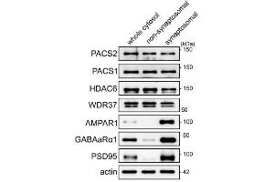 anti-gamma-aminobutyric Acid (GABA) A Receptor, alpha 1 (GABRA1) (AA 355-394) antibody