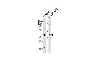 Western blot analysis of lysates from human heart tissue lysate, U-251 MG cell line (from left to right), using AKTIP Antibody (C-term) (ABIN1881052 and ABIN2838362). (AKTIP antibody  (C-Term))