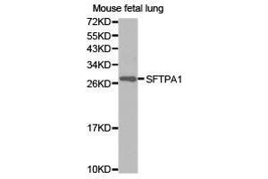 Western Blotting (WB) image for anti-Surfactant Protein A1 (SFTPA1) antibody (ABIN1874759) (Surfactant Protein A1 antibody)
