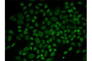 Immunofluorescence analysis of MCF-7 cells using RAD54L2 antibody. (ARIP4 antibody)