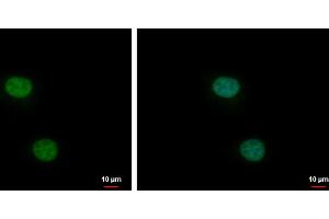 ICC/IF Image XLF antibody [N3C3] detects XLF protein at nucleus by immunofluorescent analysis.