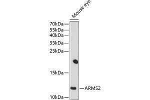 Western blot analysis of extracts of mouse eye, using  antibody (ABIN6129951, ABIN6137123, ABIN6137124 and ABIN6214318) at 1:1000 dilution.