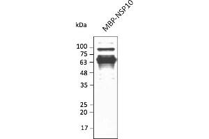 Western Blotting (WB) image for anti-SARS-CoV-2 Non-Structural Protein 10 (NSP10) antibody (ABIN7273003) (SARS-CoV-2 NSP10 antibody)