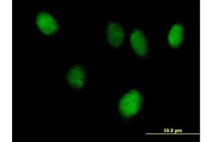 Immunofluorescence of purified MaxPab antibody to STAT6 on HeLa cell. (STAT6 antibody  (AA 1-847))