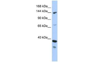 DHX37 antibody used at 1 ug/ml to detect target protein.