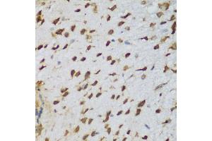Immunohistochemistry of paraffin-embedded mouse brain using NCL antibody (ABIN5975400) at dilution of 1/200 (40x lens). (Nucleolin antibody)