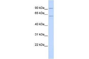 WB Suggested Anti-CUGBP2 Antibody Titration:  0. (CELF2 antibody  (N-Term))