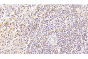 Detection of GM-CSF in Human Spleen Tissue using Polyclonal Antibody to Colony Stimulating Factor 2, Granulocyte Macrophage (GM-CSF) (GM-CSF antibody  (AA 18-144))