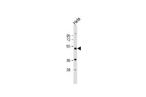 Anti-NR1I2 Antibody (Center) at 1:1000 dilution + Hela whole cell lysate Lysates/proteins at 20 μg per lane. (NR1I2 antibody  (AA 100-127))