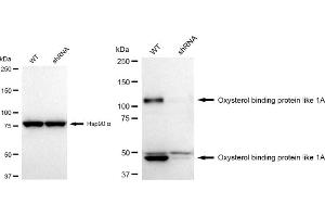 Western blotting analysis using Oxysterol binding protein like 1A antibody (ABIN7799716).
