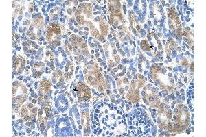 SLC36A3 antibody was used for immunohistochemistry at a concentration of 4-8 ug/ml to stain Epithelial cells of renal tubule (arrows) in Human Kidney.