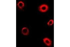 Immunofluorescent analysis of TBRG4 staining in Hela cells.