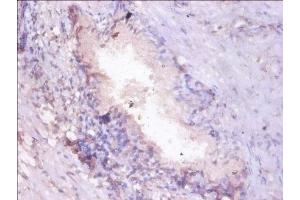 Immunohistochemistry (IHC) image for anti-Proteasome Subunit alpha  7 (PSMA7) (AA 5-232) antibody (ABIN7164964)