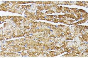 Immunohistochemistry of paraffin-embedded Mouse heart using TRAP1 Polyclonal Antibody at dilution of 1:100 (40x lens). (TRAP1 antibody)