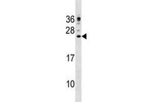 CAMP antibody western blot analysis in NCI-H292 lysate (Cathelicidin antibody  (AA 123-152))