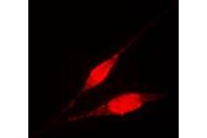 Immunofluorescence (IF) image for anti-Inhibitor of kappa Light Polypeptide Gene Enhancer in B-Cells, Kinase gamma (IKBKG) (Center) antibody (ABIN7297398)