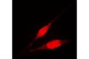 Immunofluorescent analysis of IKK gamma staining in HL60 cells. (IKBKG antibody  (Center))