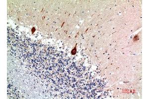 Immunohistochemistry (IHC) analysis of paraffin-embedded Human Brain, antibody was diluted at 1:100. (Nodal antibody)