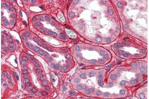 Kidney: Formalin-Fixed Paraffin-Embedded (FFPE) (Collagen IV antibody)