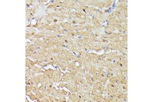 Immunohistochemistry of paraffin-embedded rat heart using TRIP4 antibody (ABIN7270824) at dilution of 1:100 (40x lens). (TRIP4 antibody  (AA 282-581))