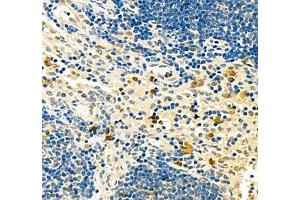 Immunohistochemistry (Paraffin-embedded Sections) (IHC (p)) image for anti-Baculoviral IAP Repeat Containing 3 (BIRC3) antibody (ABIN7073179)