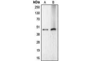 Western blot analysis of LASS4 expression in HeLa (A), Jurkat (B) whole cell lysates.