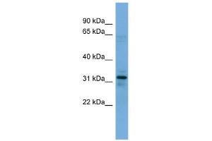 MYOZ1 antibody used at 0. (Myozenin 1 antibody  (N-Term))