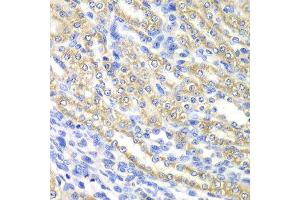 Immunohistochemistry of paraffin-embedded rat kidney using SURF1 antibody at dilution of 1:100 (x40 lens). (SURF1 antibody)