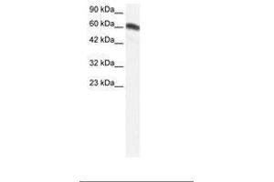 Image no. 1 for anti-Forkhead Box C2 (MFH-1, Mesenchyme Forkhead 1) (FOXC2) (AA 212-261) antibody (ABIN202667) (FOXC2 antibody  (AA 212-261))