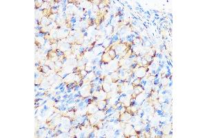 Immunohistochemistry of paraffin-embedded rat ovary using Filamin A Rabbit mAb (ABIN1682545, ABIN3018024, ABIN3018025 and ABIN7101570) at dilution of 1:100 (40x lens). (Filamin A antibody)