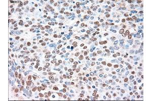 Immunohistochemical staining of paraffin-embedded liver tissue using anti-SIGLEC9mouse monoclonal antibody. (SIGLEC9 antibody)