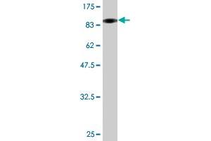 Western Blot detection against Immunogen (143 KDa) . (Vinculin antibody  (AA 1-1066))