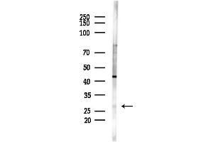anti-Nucleoredoxin Like Protein 1 (NXNL1) (N-Term) antibody
