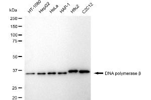Western blotting analysis using DNA polymerase beta antibody (ABIN7799875).