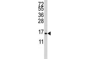 Western blot analysis of S100A11 antibody and CEM lysate. (S100A11 antibody  (AA 1-30))