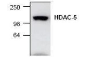Image no. 1 for anti-Histone Deacetylase 5 (HDAC5) antibody (ABIN127240)