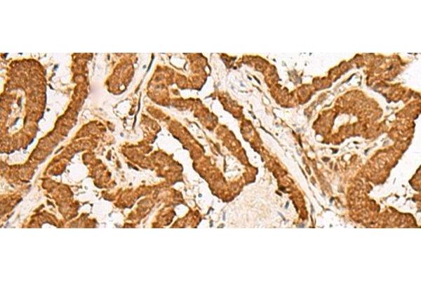 GMEB2 antibody