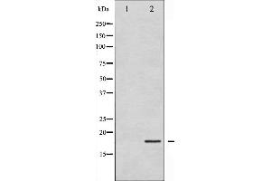 Western blot analysis of Cofilin expression in COLO205 whole cell lysates,The lane on the left is treated with the antigen-specific peptide. (Cofilin antibody  (N-Term))