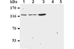 Western Blotting (WB) image for anti-Budding Uninhibited By Benzimidazoles 1 Homolog beta (Yeast) (BUB1B) antibody (ABIN567606)