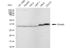 Western blotting analysis using Emerin antibody (ABIN7798436).