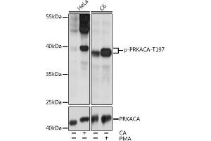 Western blot analysis of extracts of various cell lines, using Phospho-PKA C-alpha (PRKACA)-T197 pAb (ABIN6135290, ABIN6136202, ABIN6136203 and ABIN6225582) at 1:2000 dilution or PKA C-alpha (PRKACA) antibody (ABIN7269625). (PRKACA antibody  (pThr197))