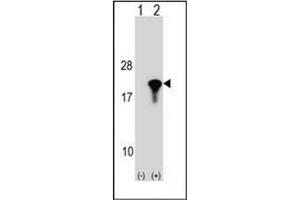 Western blot analysis of PPIL1 (arrow) using PPIL1 Antibody (Center) Cat. (PPIL1 antibody  (Middle Region))