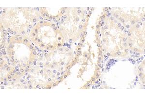 Detection of GNb2 in Human Kidney Tissue using Polyclonal Antibody to G Protein Beta 2 (GNb2) (GNB2 antibody  (AA 2-340))