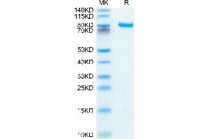 SDS-PAGE (SDS) image for delta-Like 4 (DLL4) (AA 27-524) protein (Fc Tag) (ABIN7274485)