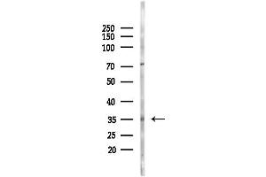 anti-Melanoma Antigen Family A, 9 (MAGEA9) (N-Term) antibody