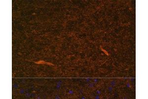 Immunofluorescence analysis of Rat brain using TEK Polyclonal Antibody at dilution of 1:100. (TEK antibody)