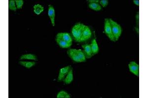 Immunofluorescence staining of HepG2 cells with ABIN7167935 at 1:66, counter-stained with DAPI. (ARHGAP18 antibody  (AA 389-577))