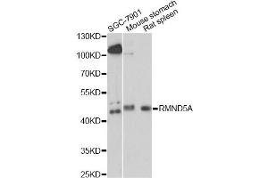 Western blot analysis of extracts of various cell lines, using RMND5A antibody. (RMND5A antibody)