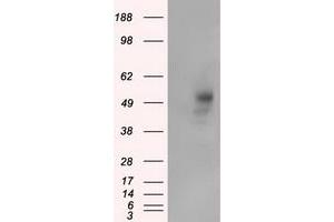 Western Blotting (WB) image for anti-Protein Kinase, CAMP-Dependent, Regulatory, Type II, alpha (PRKAR2A) antibody (ABIN1500255)